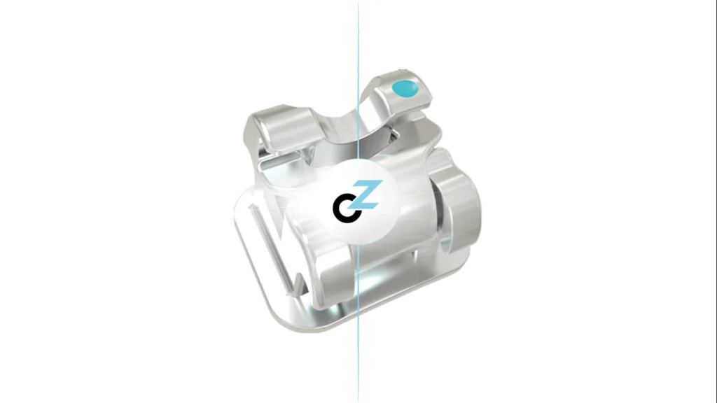 Aparelho Autoligado: o que é, vantagens e como funciona