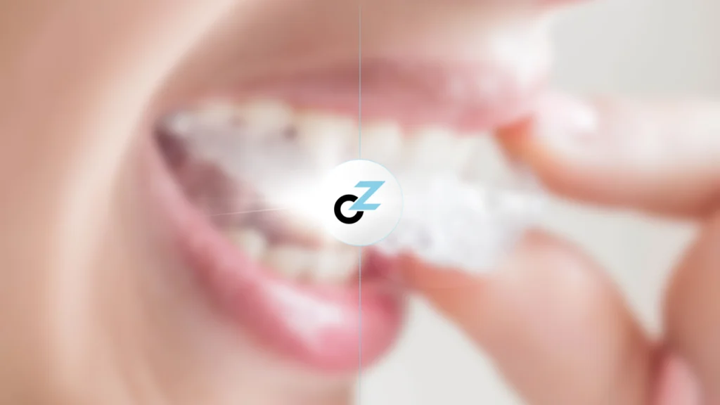 Aparelho Invisível Vale a Pena? Descubra os Prós e Contras