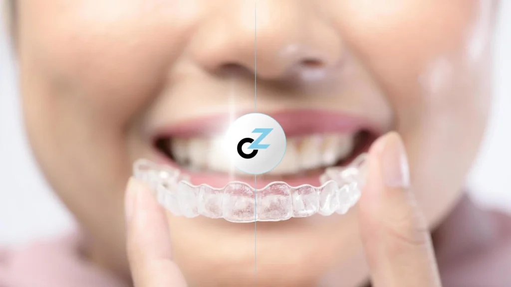 Benefícios do Aparelho Transparente: 5 Vantagens Reais