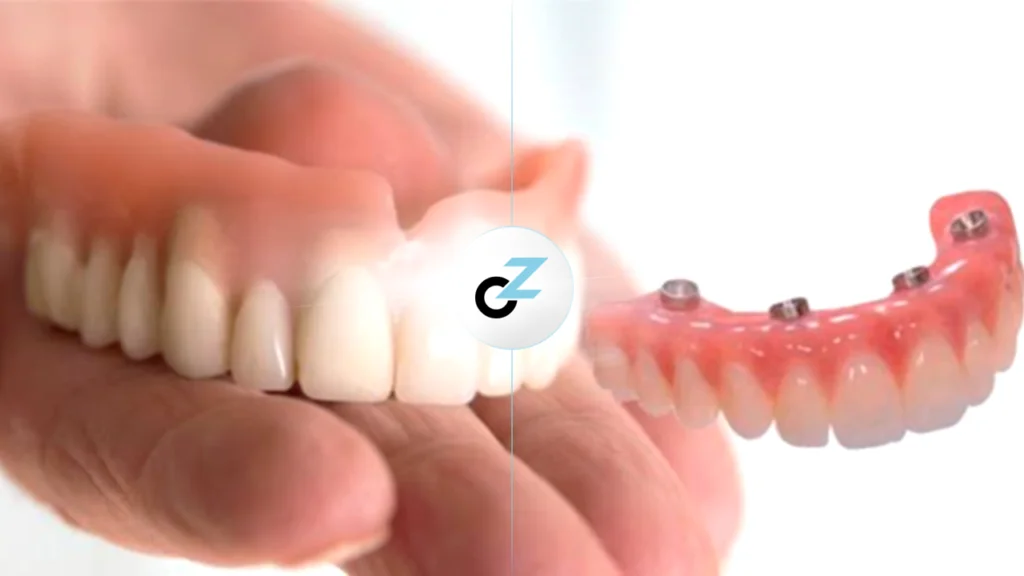 Dentadura ou Implante Dentário: qual escolher?