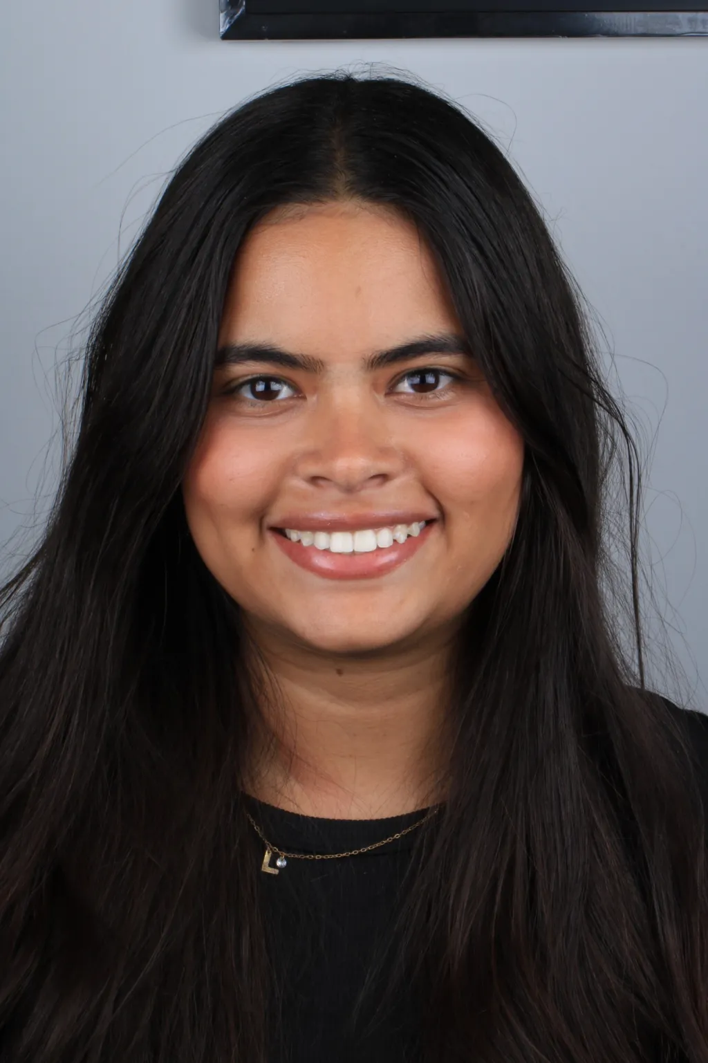 Rosto da Larissa depois do tratamento com alinhadores transparentes