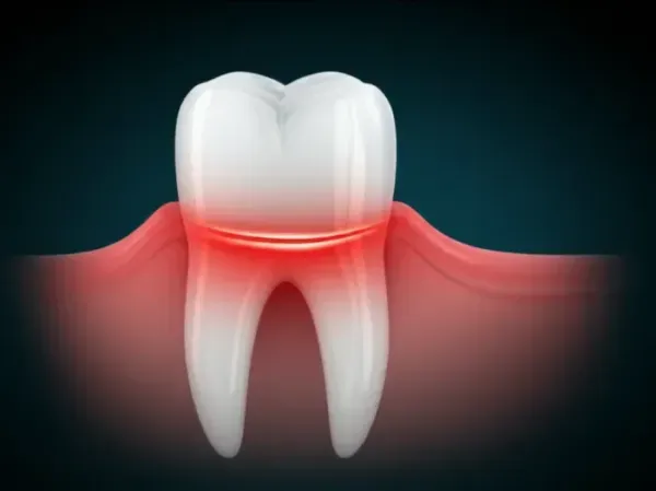 Urgências Odontológicas