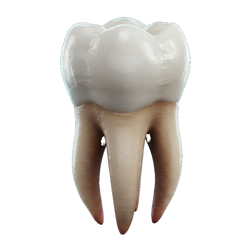 Dente siso 3D - Extração de sisos com segurança - OdontoZ