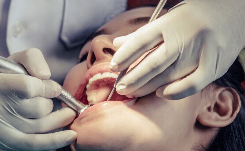 dentistas-tratam-os-dentes-dos-pacientes (1)